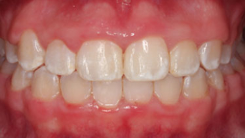 After image