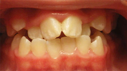 Before image